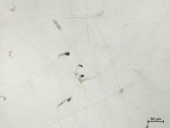 Colletotrichum_sp_1