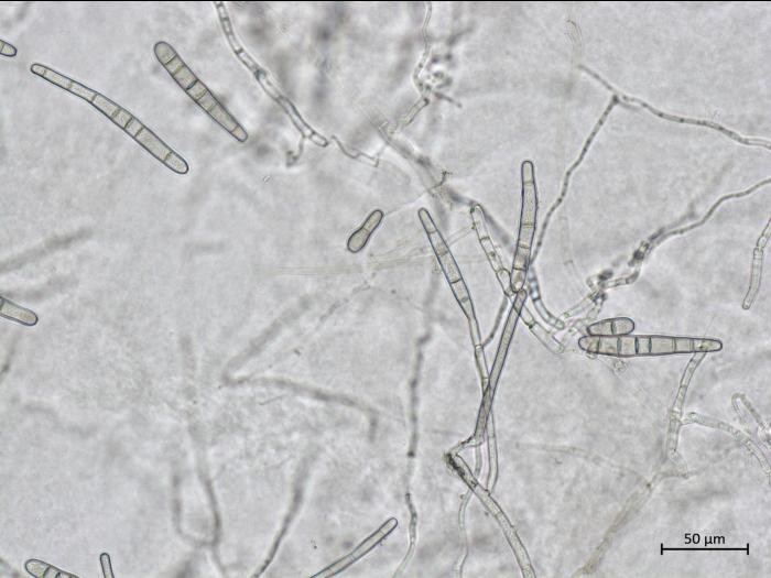 Corynespora_sp_2
