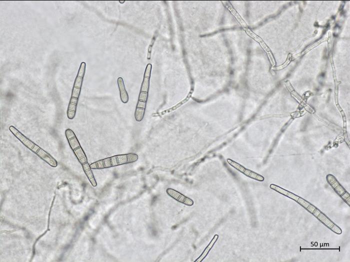 Corynespora_cassiicola_2