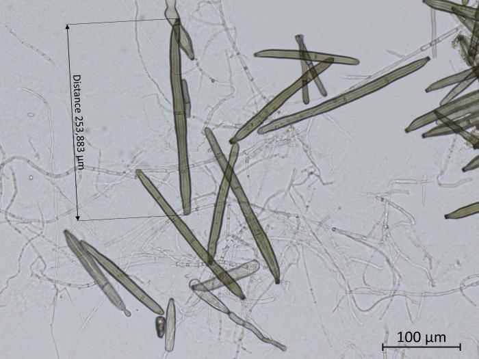 Corynespora_cassiicola_4