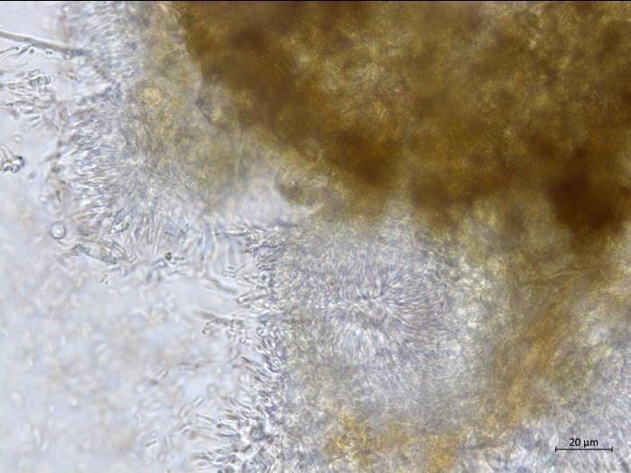 Cytospora_chrysosperma_1