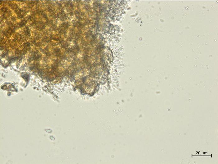 Diaporthe_vaccinii_2