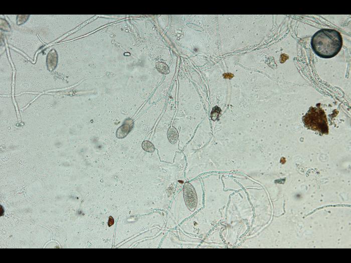 Phytophthora infestans