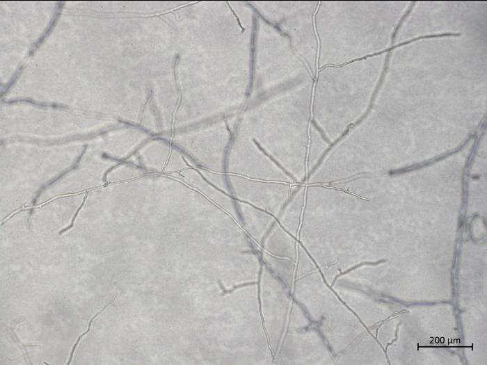 Aphanomyces_euteiches_1