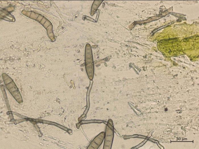 Bipolaris_sorokiniana_5