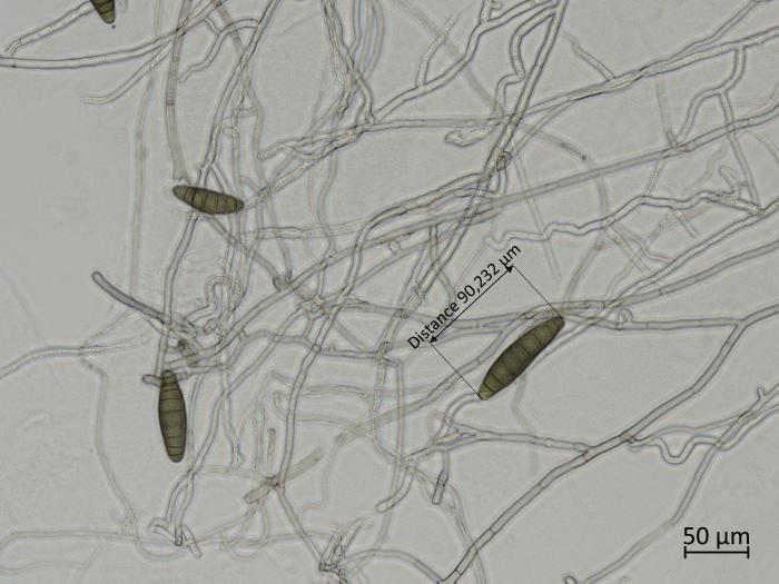 Bipolaris_sorokiniana_3