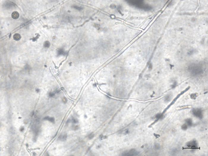 Globisporangium_irregulare_1