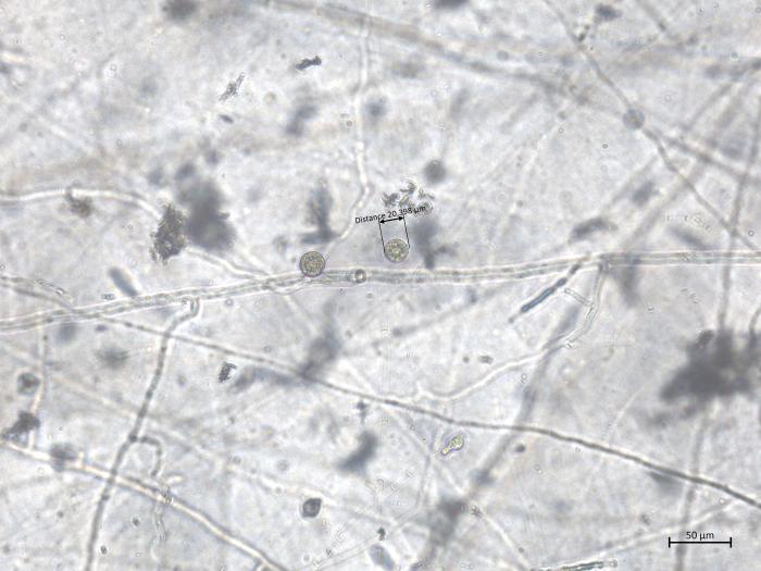 Globisporangium_irregulare_2