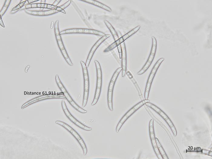 Neocosmospora_solani_1