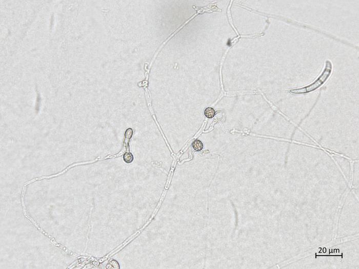 Neocosmospora_solani_4