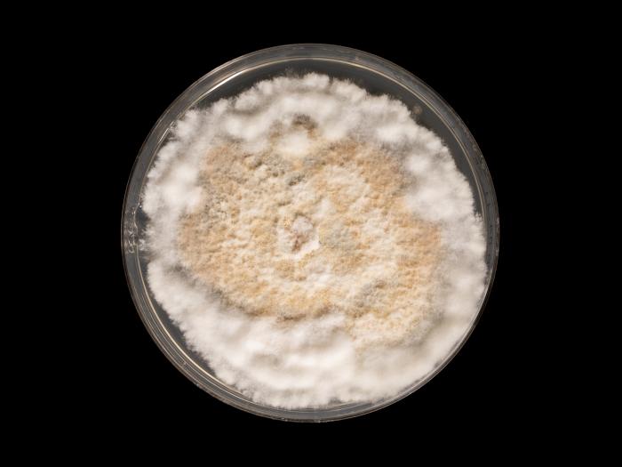 Neopestalotiopsis_sp_4