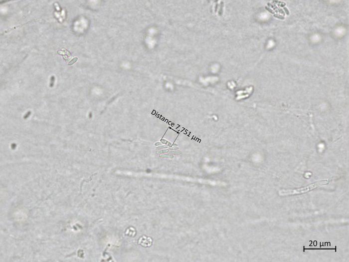 Plectosphaerella_cucumerina_3