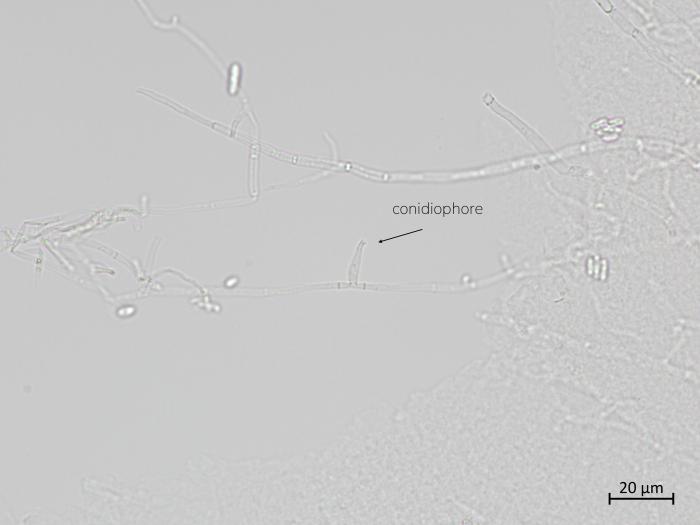 Plectosphaerella_cucumerina_4