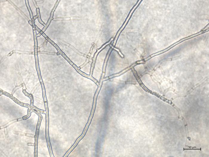 Rhizoctonia_solani_6