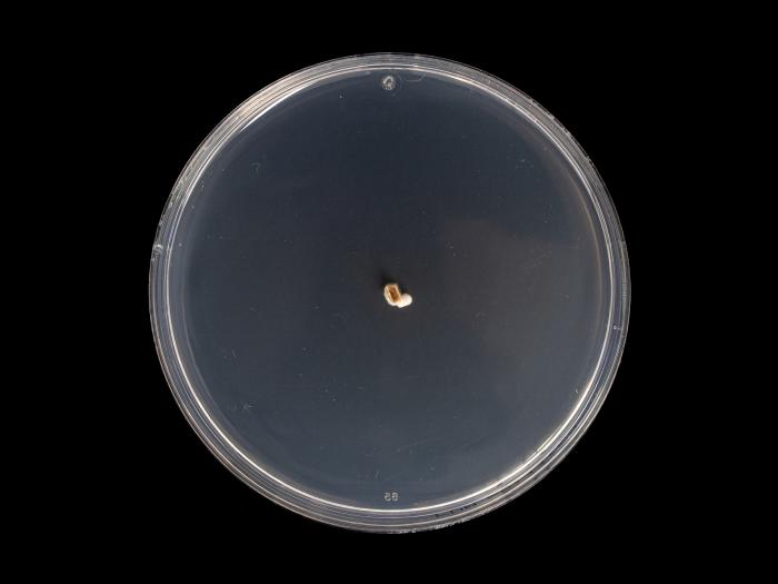 Diplocarpon_fragariae_1