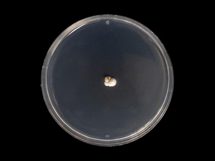 Diplocarpon_fragariae_2