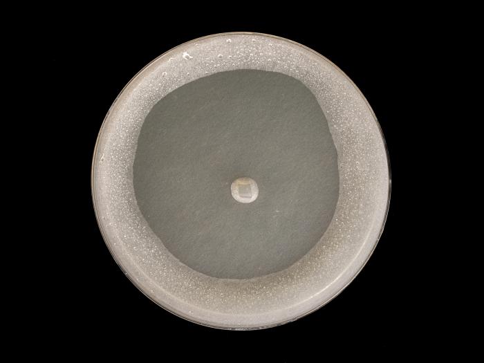 Globisporangium_irregulare_7