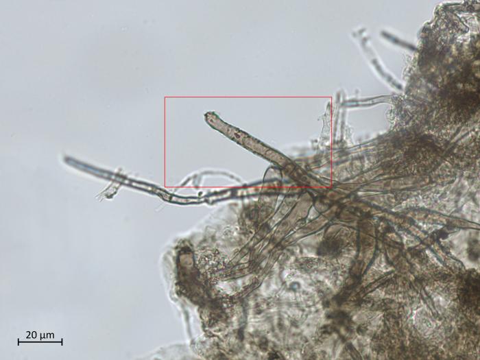 Helminthosporium_solani_9