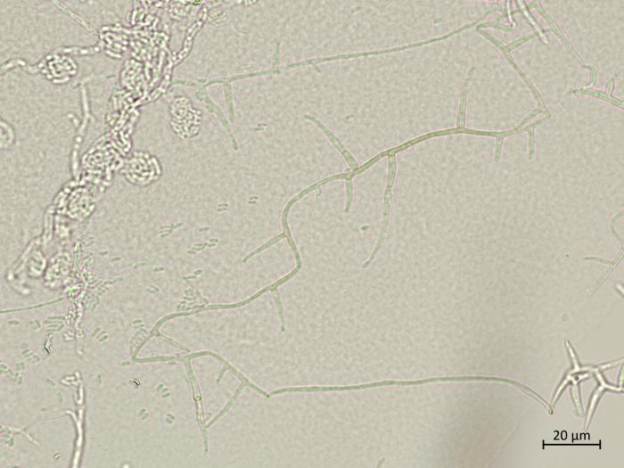 Phaeoacremonium_minimum_7