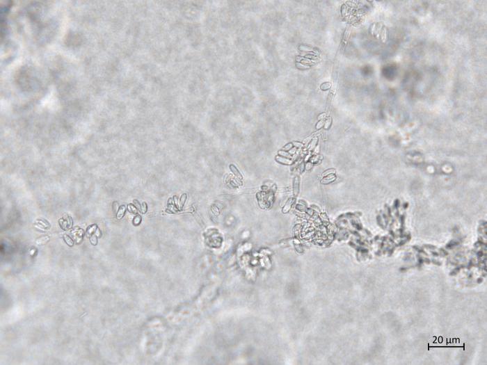Aureobasidium_pullulans_5