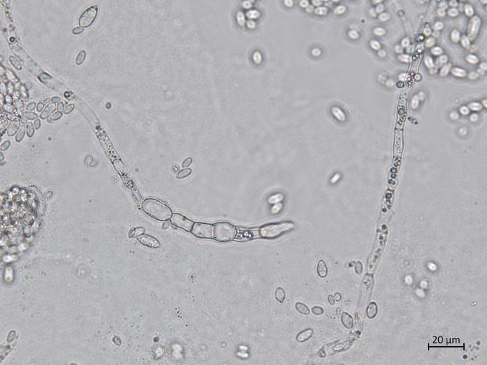 Aureobasidium_pullulans_6