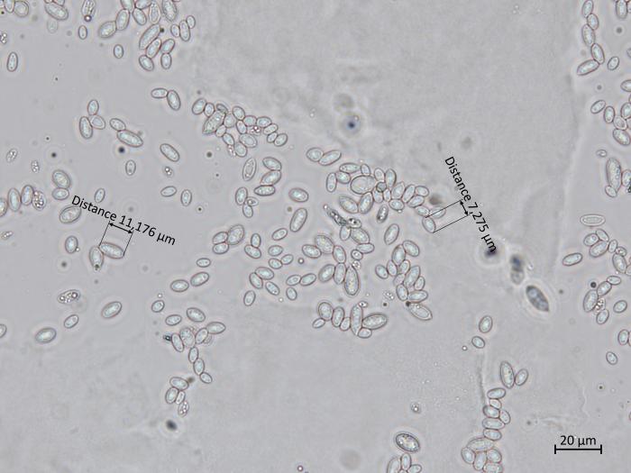 Aureobasidium_pullulans_7