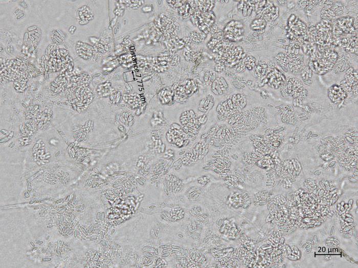 Cadophora_luteo-olivacea_7