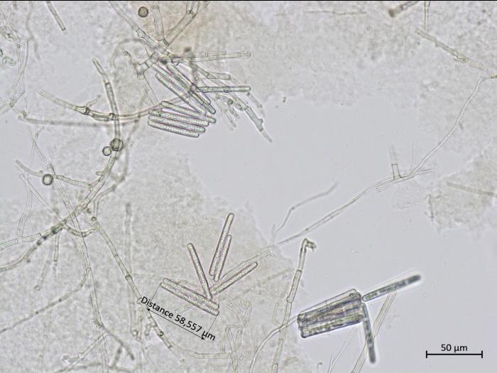 Calonectria_canadiana_1