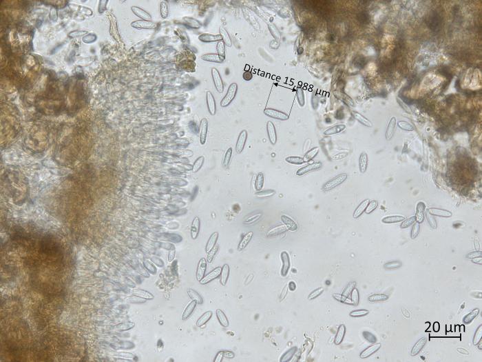 Colletotrichum_sp_2
