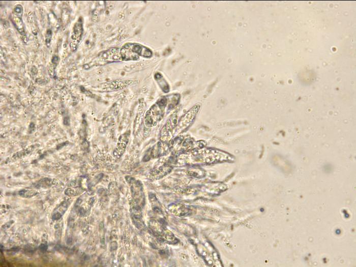 Colletotrichum_gloeosporioides_3