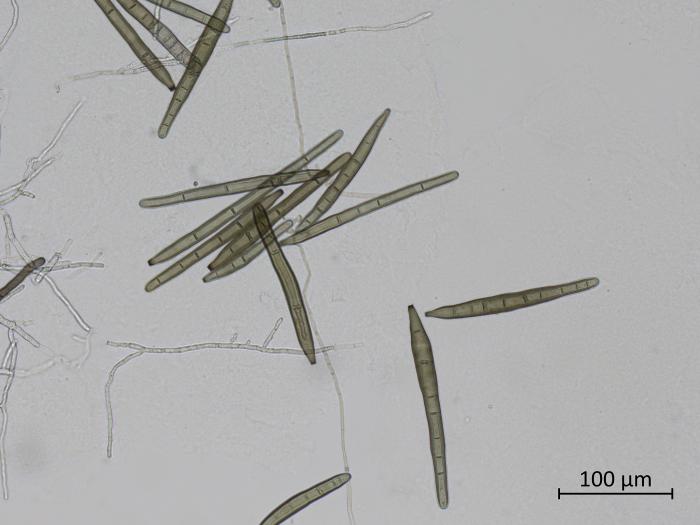 Corynespora_cassiicola_3