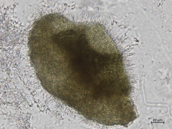 Cytospora_chrysosperma_7