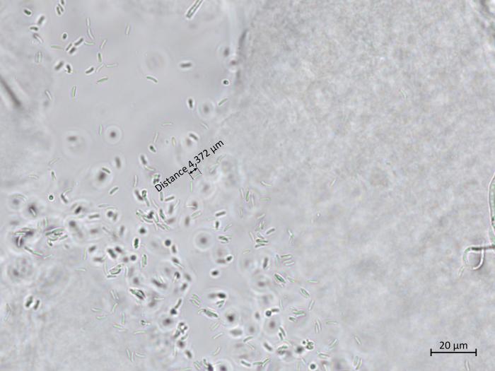 Cytospora_sp_5