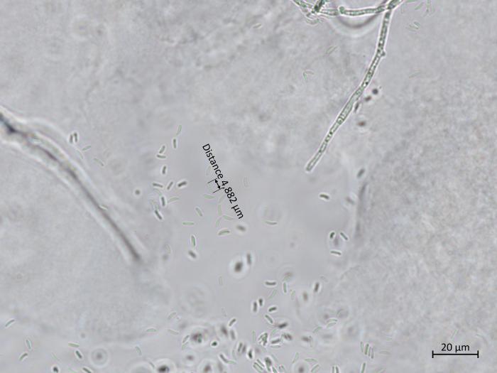 Cytospora_chrysosperma_8