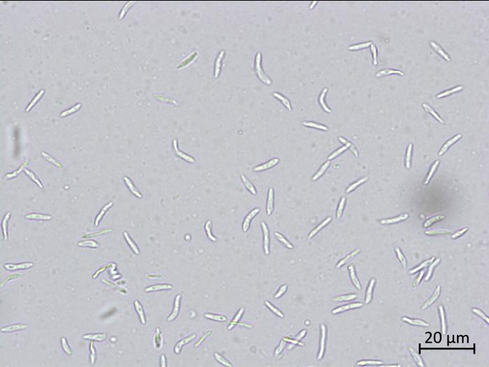 Diaporthe_caulivora_3