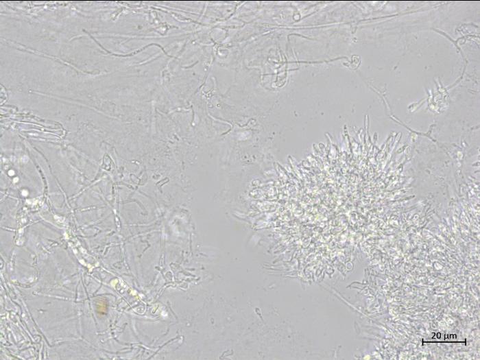 Diaporthe_caulivora_1