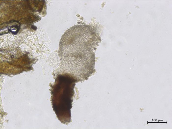 Diaporthe_caulivora_2