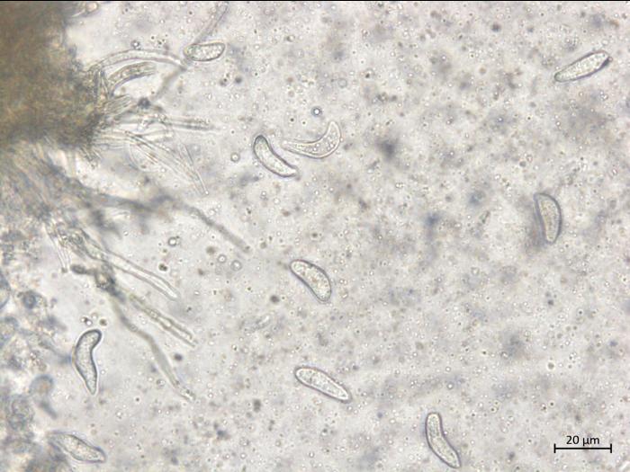 Drepanopeziza_ribis_2