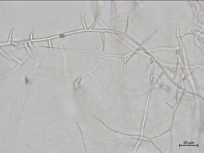 Phaeoacremonium_fraxinopennsylvanicum_3