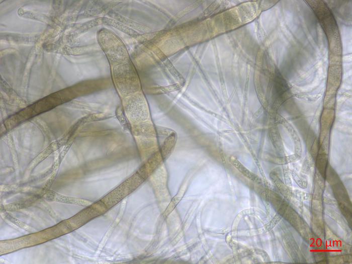 Pyrenophora_tritici-repentis_1