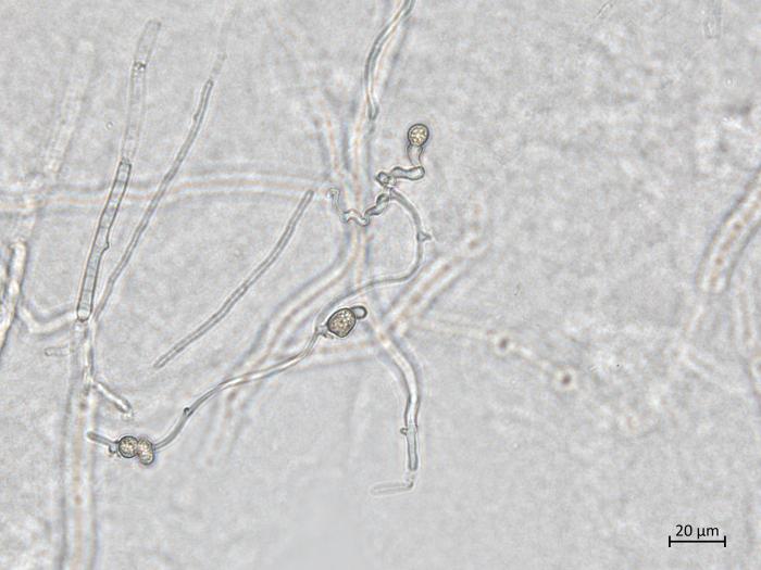 Neocosmospora_phaseoli_8