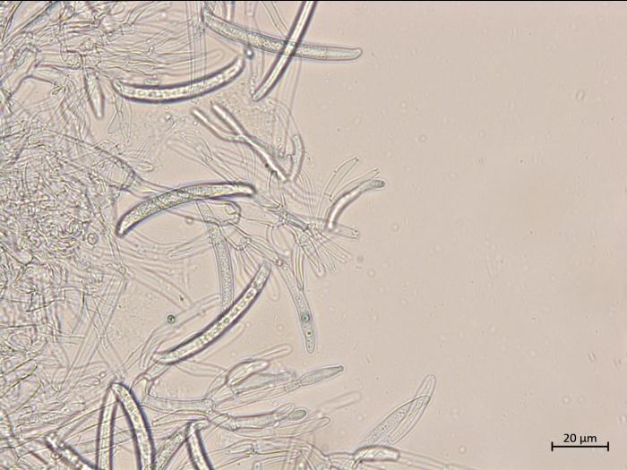 Neocosmospora_phaseoli_11