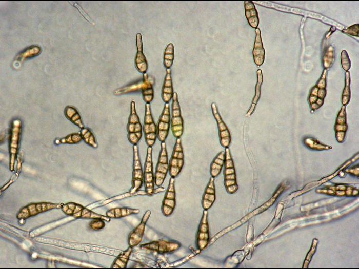Alternaria_alternata-02_LQ