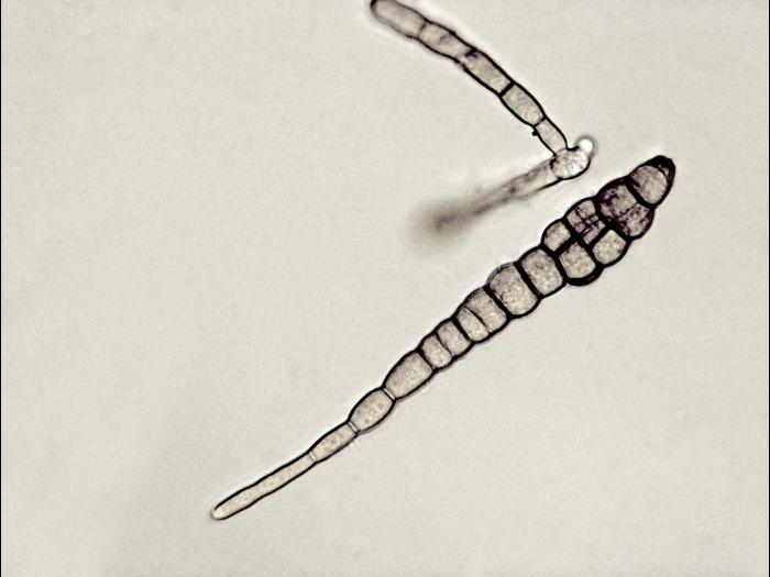 Alternaria_brassicae-32_LQ