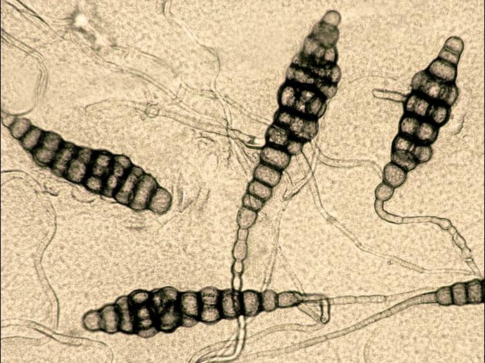 Alternaria_brassicae-35_LQ