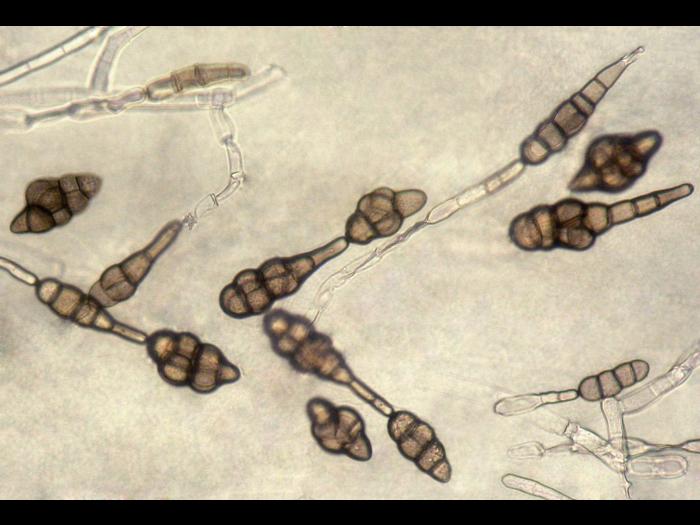 Alternaria_raphani_04_LQ.jpg