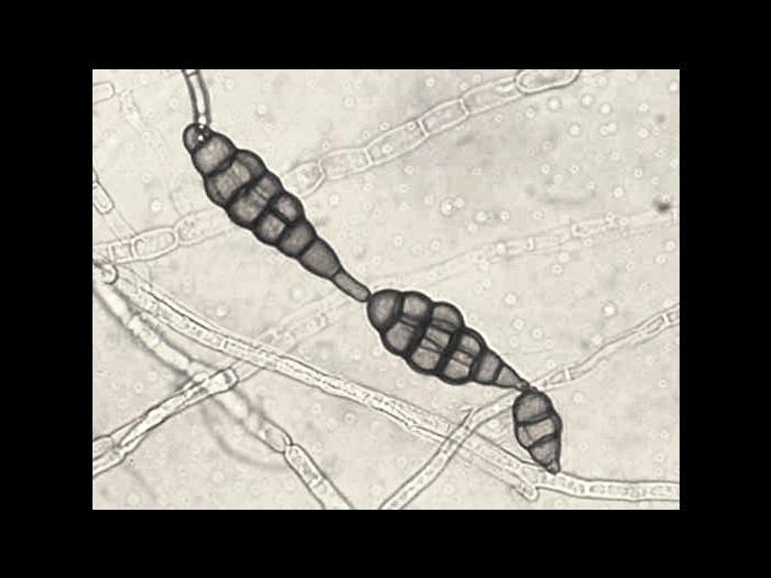 Alternaria_raphani-09_LQ