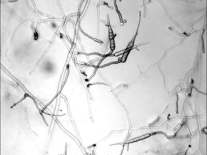 Alternaria_solani-01_LQ