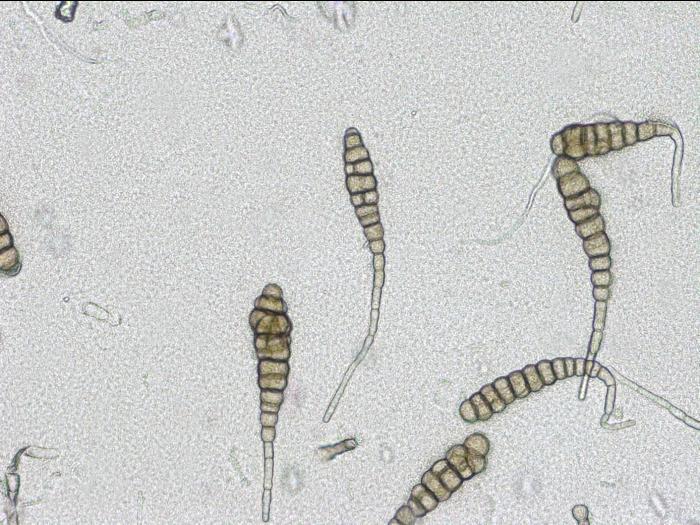 Alternaria_solani_D53639_C_LQ.jpg