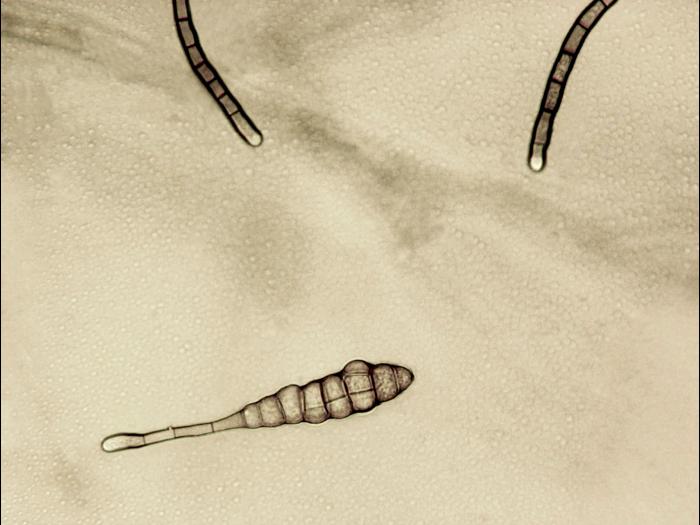 Alternaria_tagetica-01_LQ